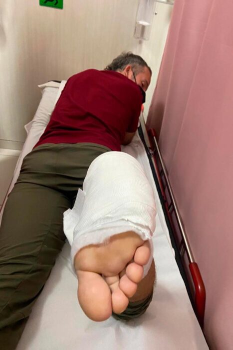 Descuento IATI Seguros 2025 29 Toni con el pie escayolado